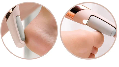 LIXA ELÉTRICA REMOVEDORA DE CALOS E RACHADURAS SKIN LINE