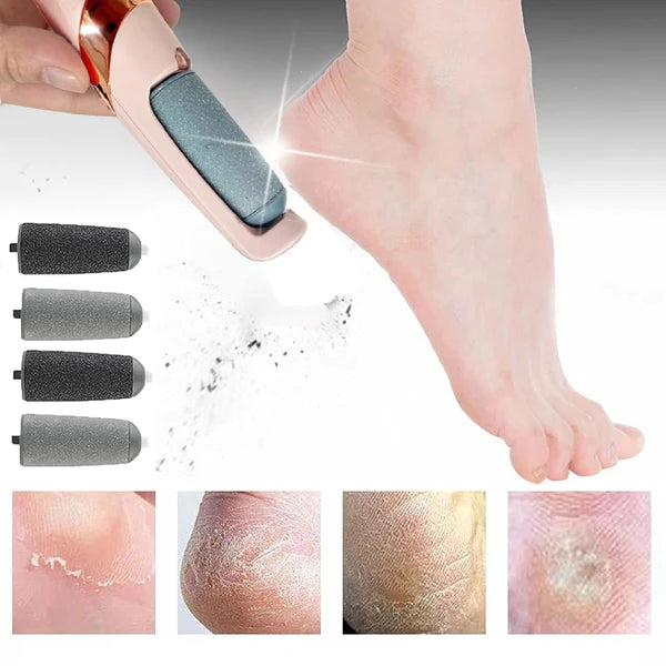 LIXA ELÉTRICA REMOVEDORA DE CALOS E RACHADURAS SKIN LINE