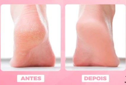 lixa-eletrica-removedora-de-calos-e-rachaduras-skin-line-tazmo-317