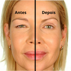 adesivo-de-palpebras-dupla-palp-lifting-600pc-tazmo-204